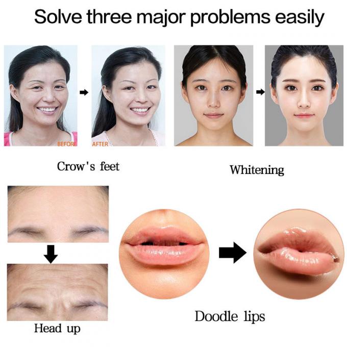 0.3 밀리람베르트 하이루론 펜 Lip 충전기 주입 분무기 고압 히알루론산은  주름살 제거 - aliexpress.com | imall.com에서 43.20달러를 희생하여  구입을 위한 어떤 바늘 메소테라피 총도 쓰지 않습니다