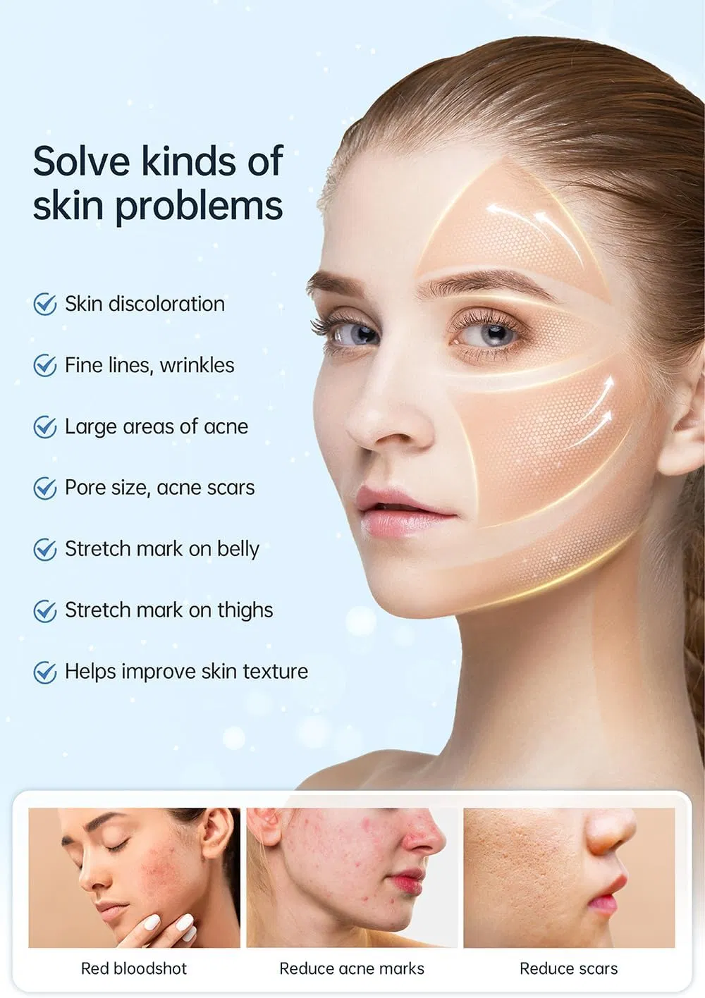 새로운 Hydra Pen H5 인fuzion Carrier serum EMS 및 마이크로네일링 자동 적용 4