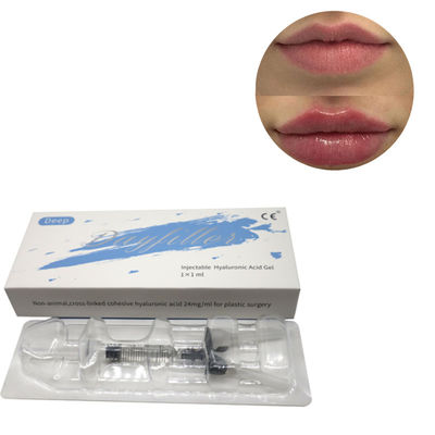 새로운 심 히알루론산 피부 필러 2ml 5ml 교차 연결